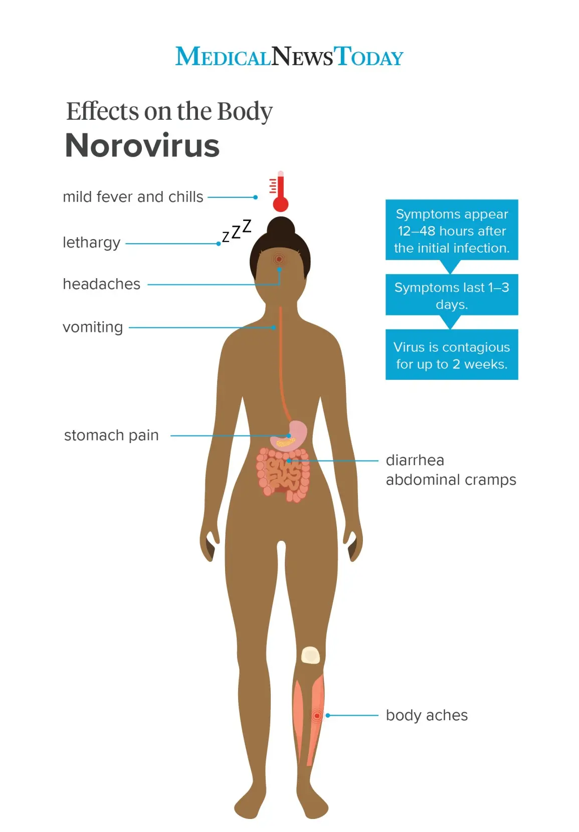 norovirus in adults