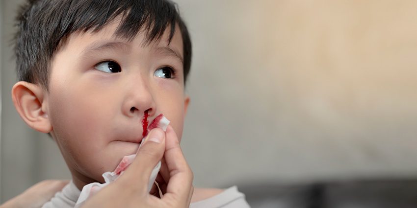 Кровотеча з носа у дитини