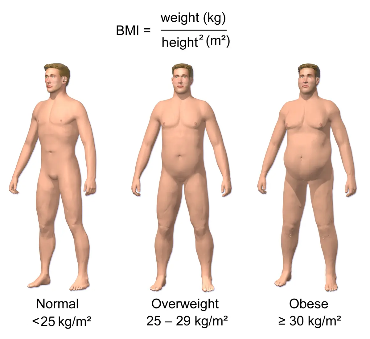 Obesity in men