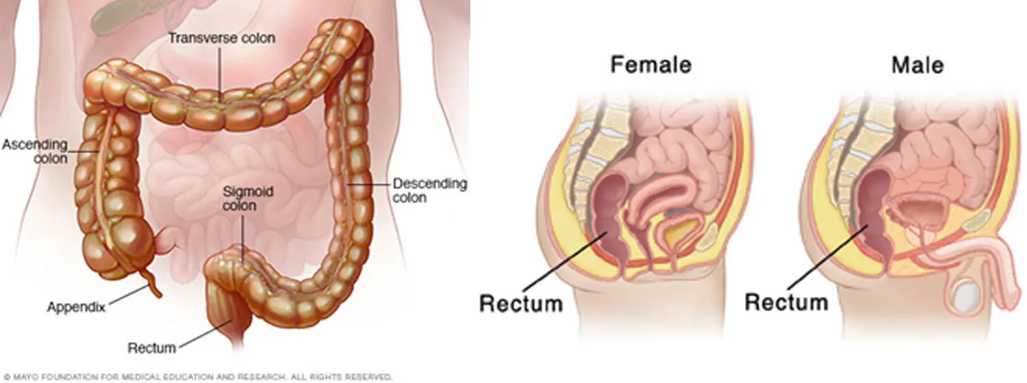 Pain in the anus in men and women