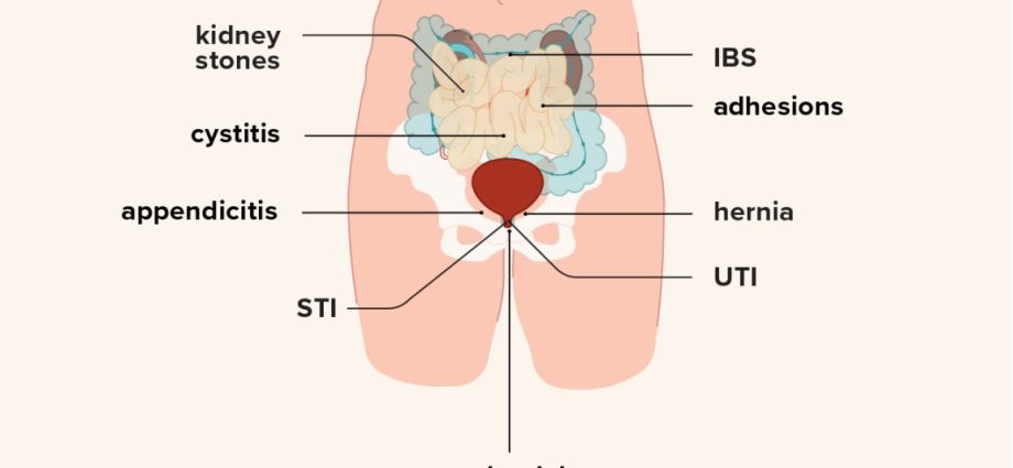 Pain in the right side in women and men