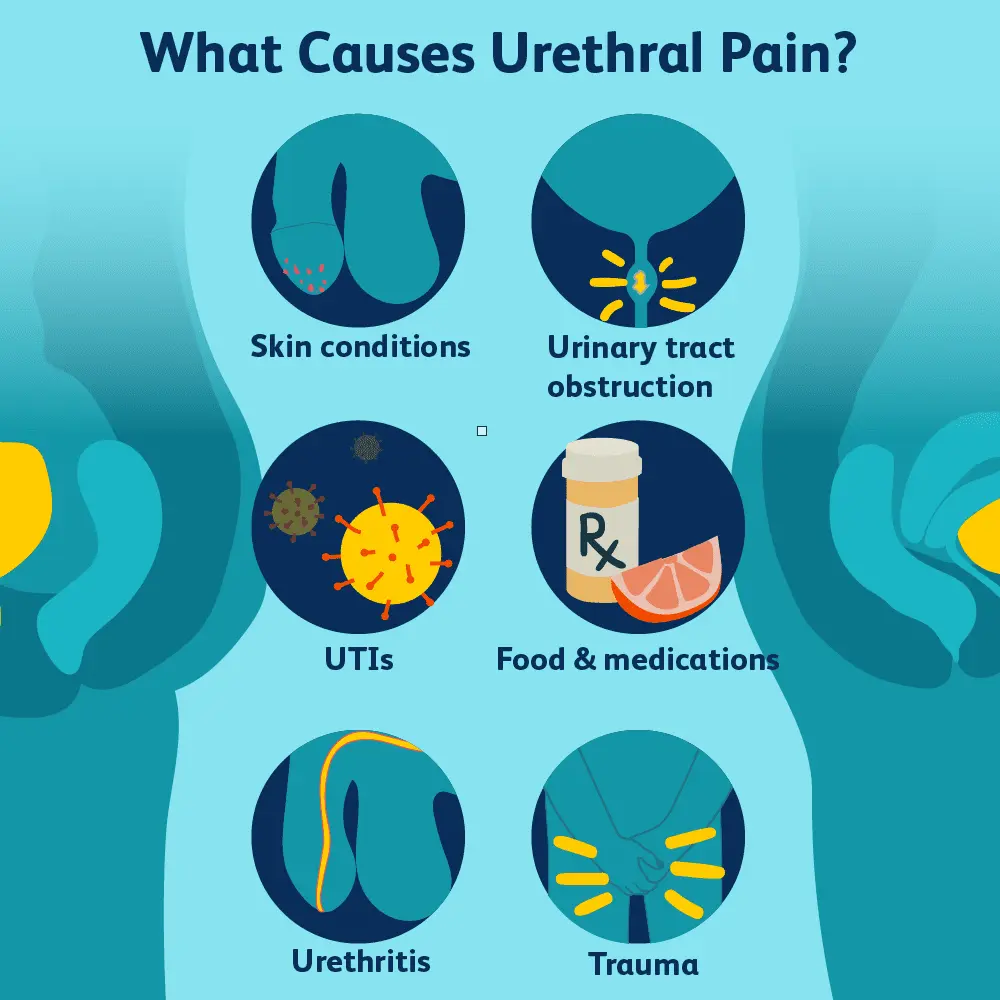 Pain when urinating in men