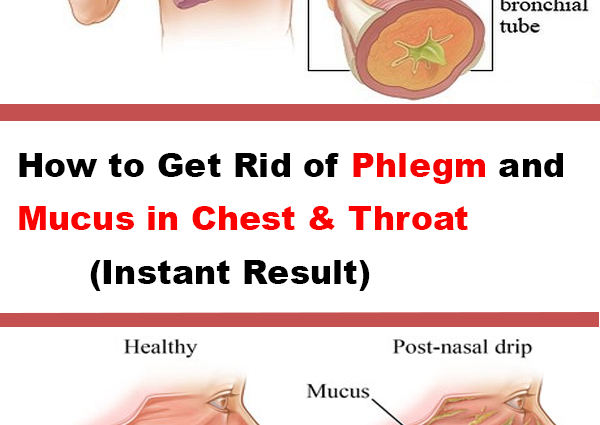 Phlegm in the throat