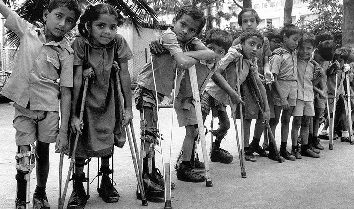 Polio in children