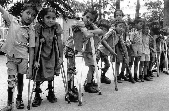 Polio in children