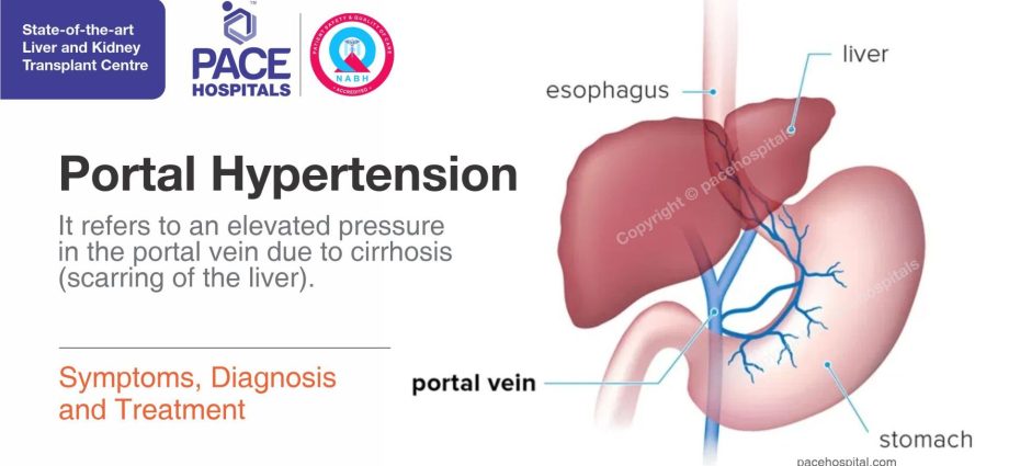 portal hypertension