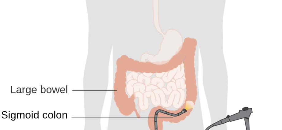 Rectoromanoscopy