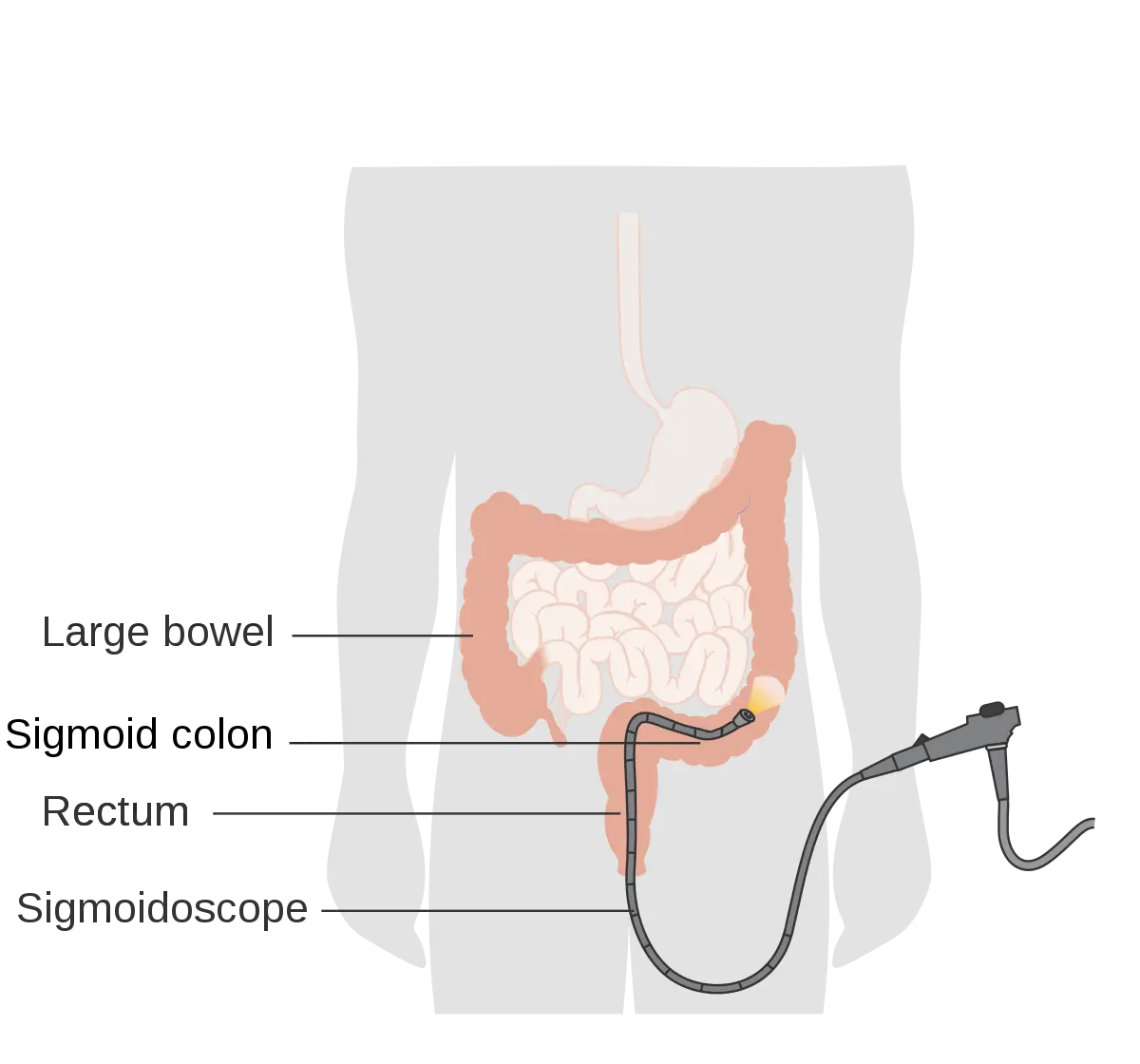 Rectoromanoscopy