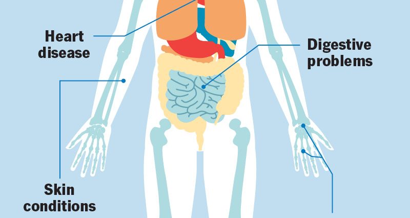 Rheumatism in adults