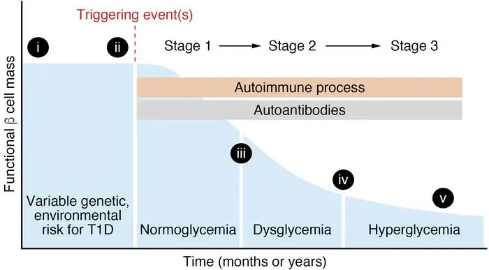 Stages of type 1 diabetes