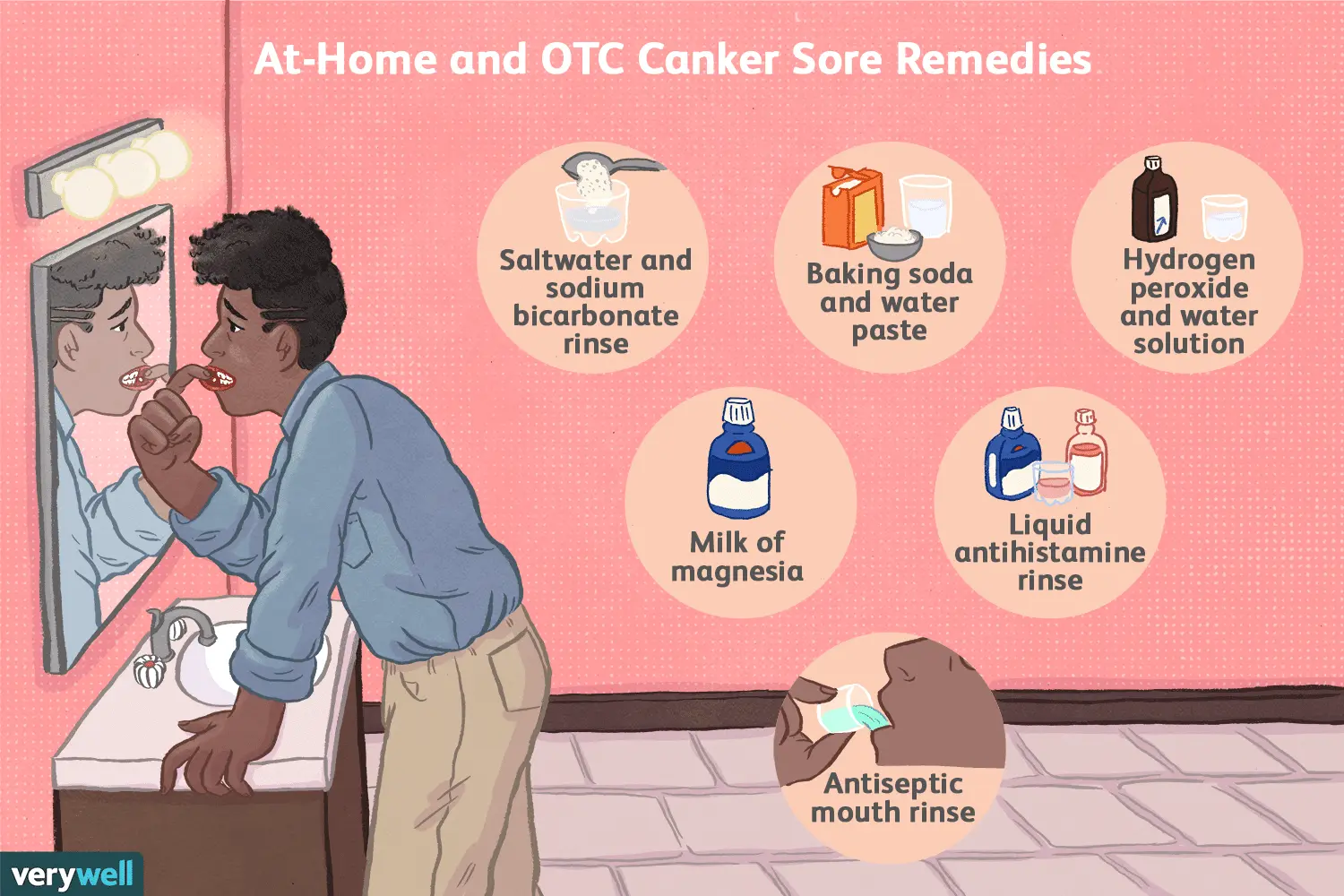 Stomatitis in adults: how to treat at home