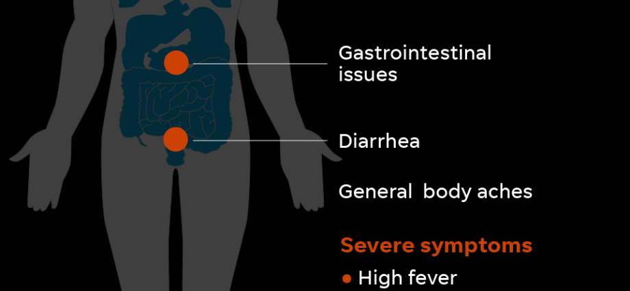 Symptoms of coronavirus in humans