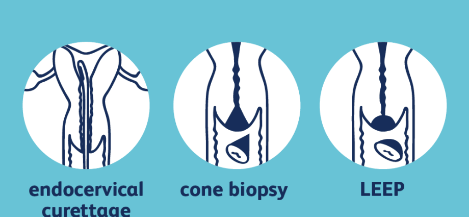 The best methods for diagnosing cervical cancer