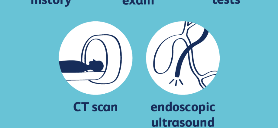 The best methods for diagnosing pancreatic cancer