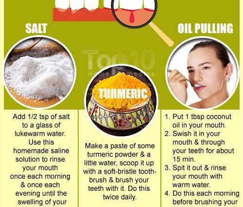 The best remedies for gingivitis