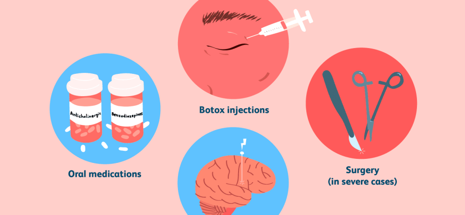 The Best Treatments for Blepharospasm