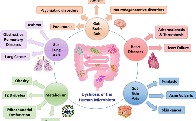 The best treatments for dysbacteriosis in adults