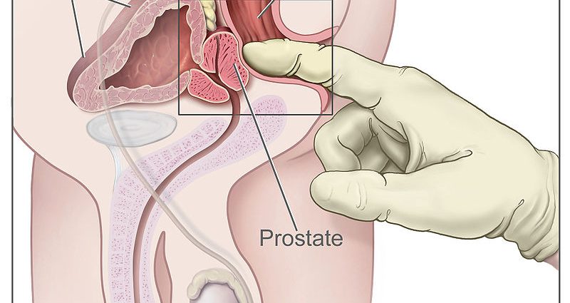 The prostate gland in men