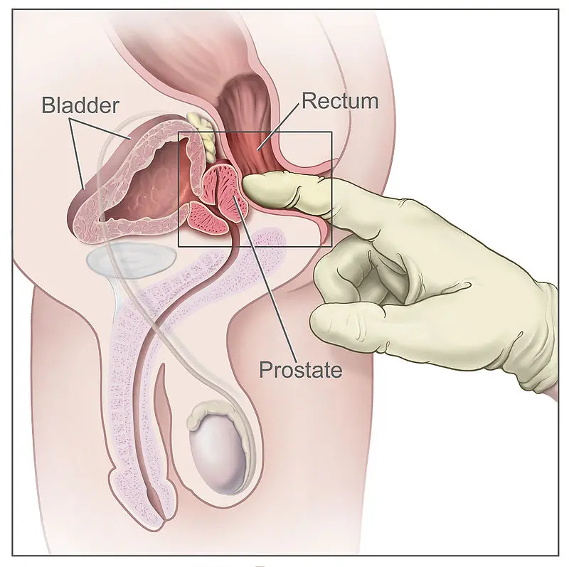 The prostate gland in men