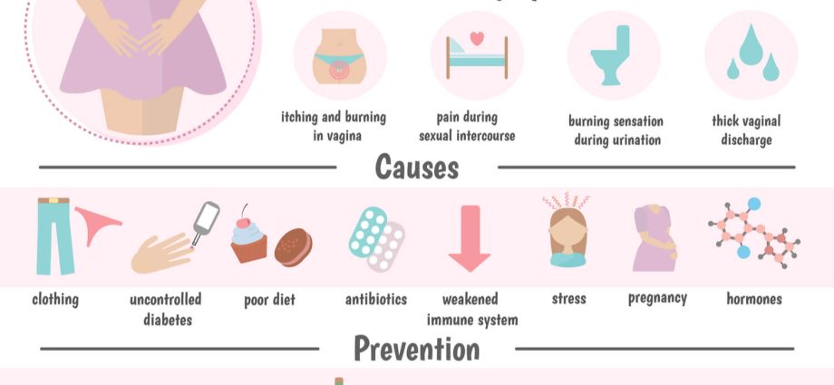 Thrush during pregnancy