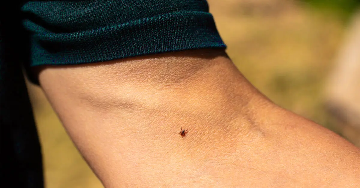 Tick ​​bite in humans