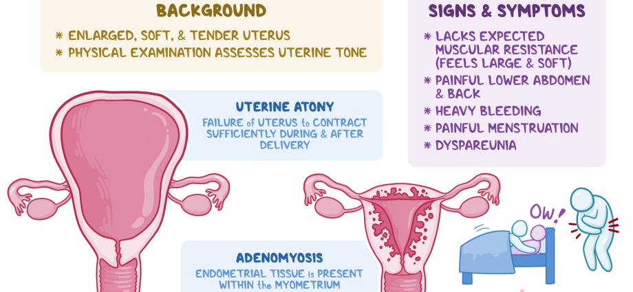 Tone of the uterus during pregnancy