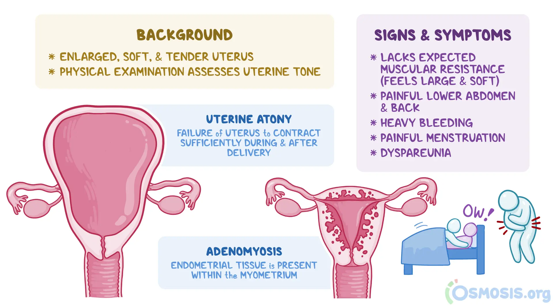 What Does Your Uterus Feel Like At 4 Weeks Pregnant