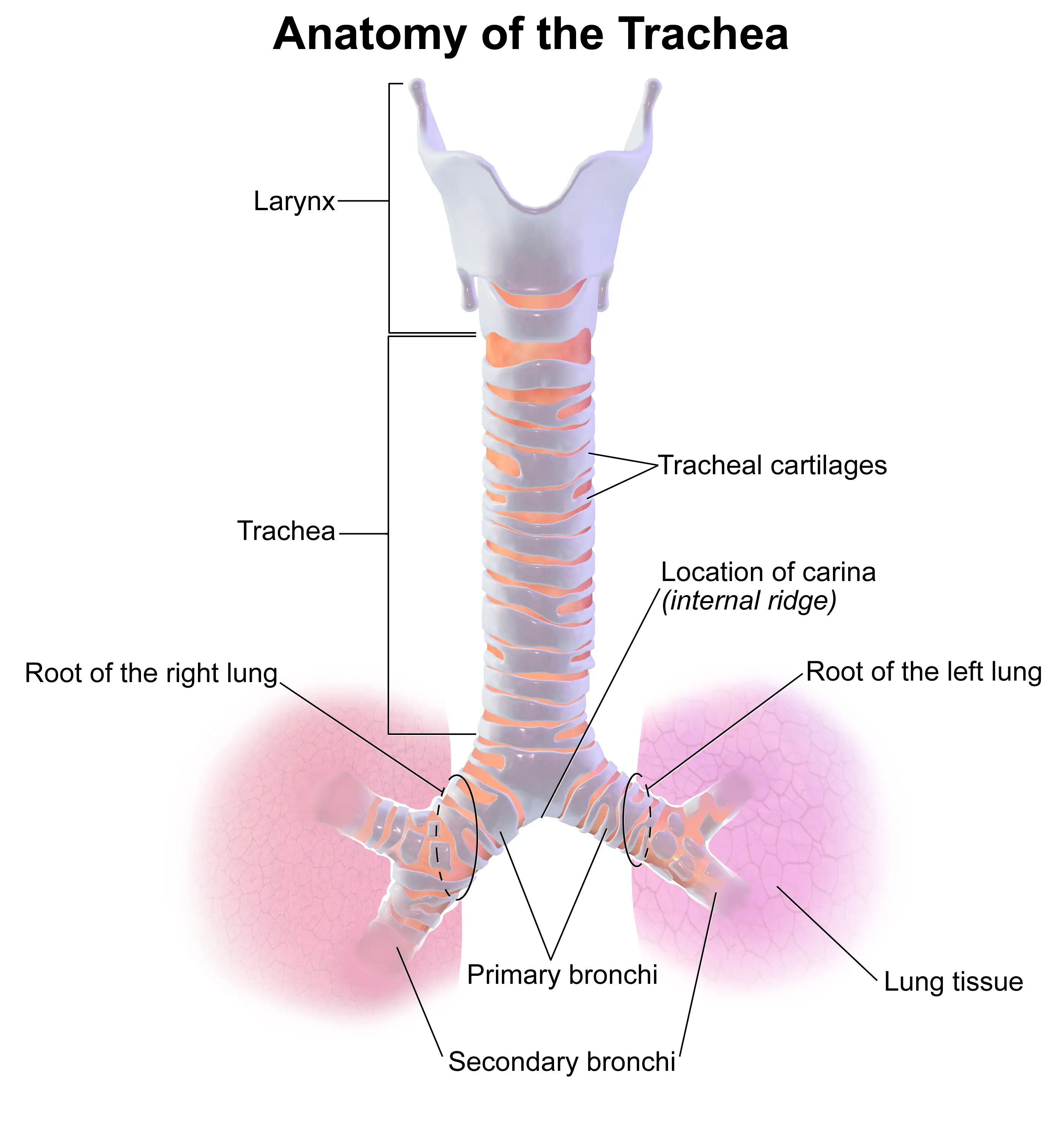 Tracheitis in adults