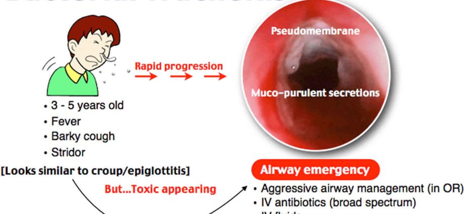 Tracheitis in children