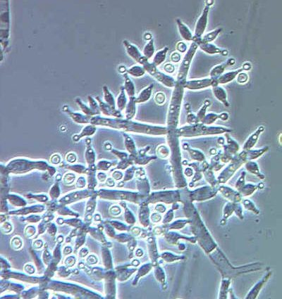 Trichoderma fungus