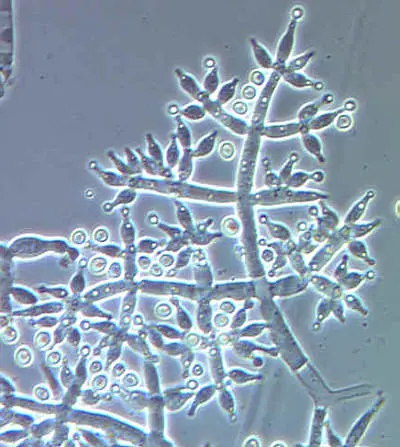 Trichoderma fungus