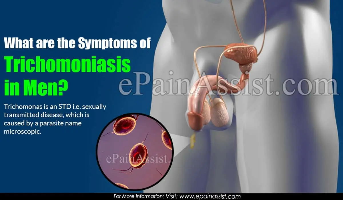 Trichomoniasis in men