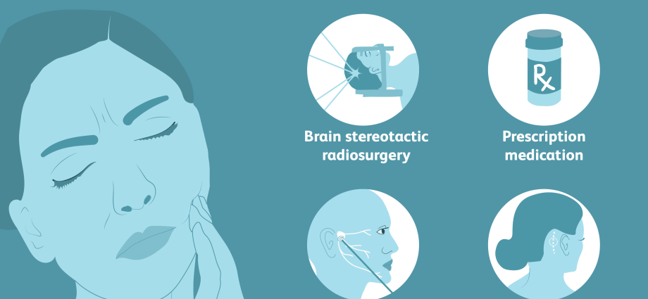 Trigeminal neuralgia in adults