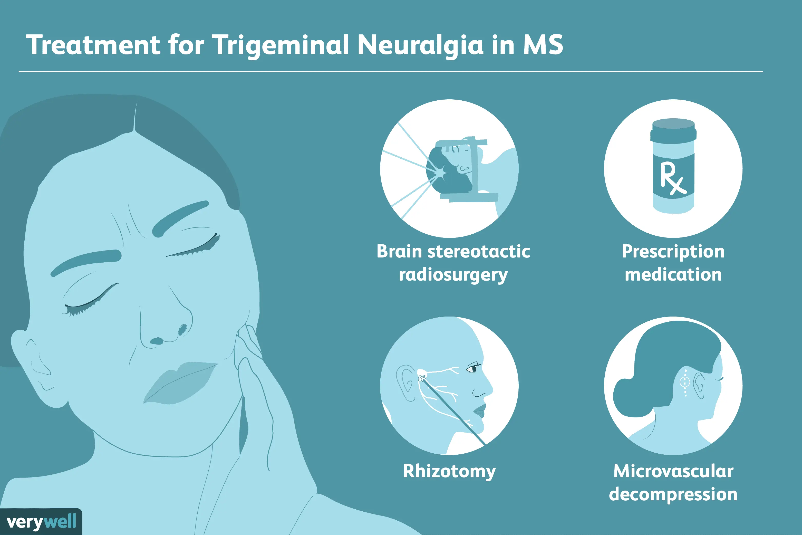 Trigeminal neuralgia in adults