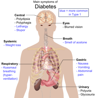 Type 1 diabetes mellitus