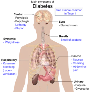 Type 1 diabetes mellitus