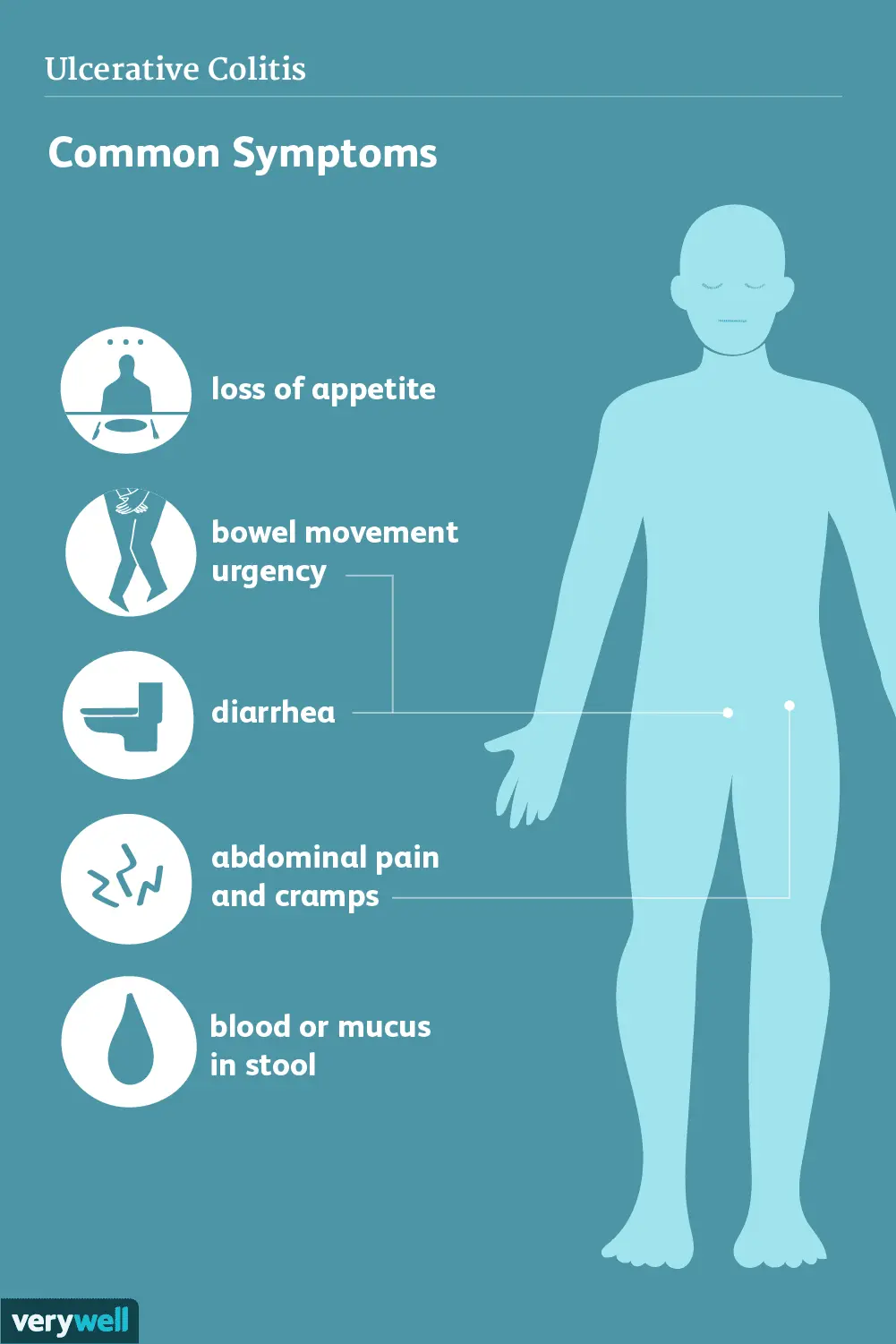 Ulcerative colitis in adults