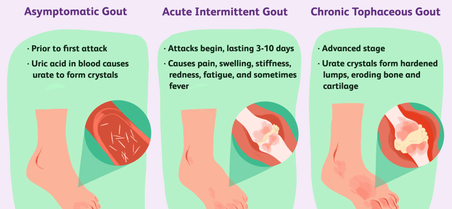 Uric acid in the blood