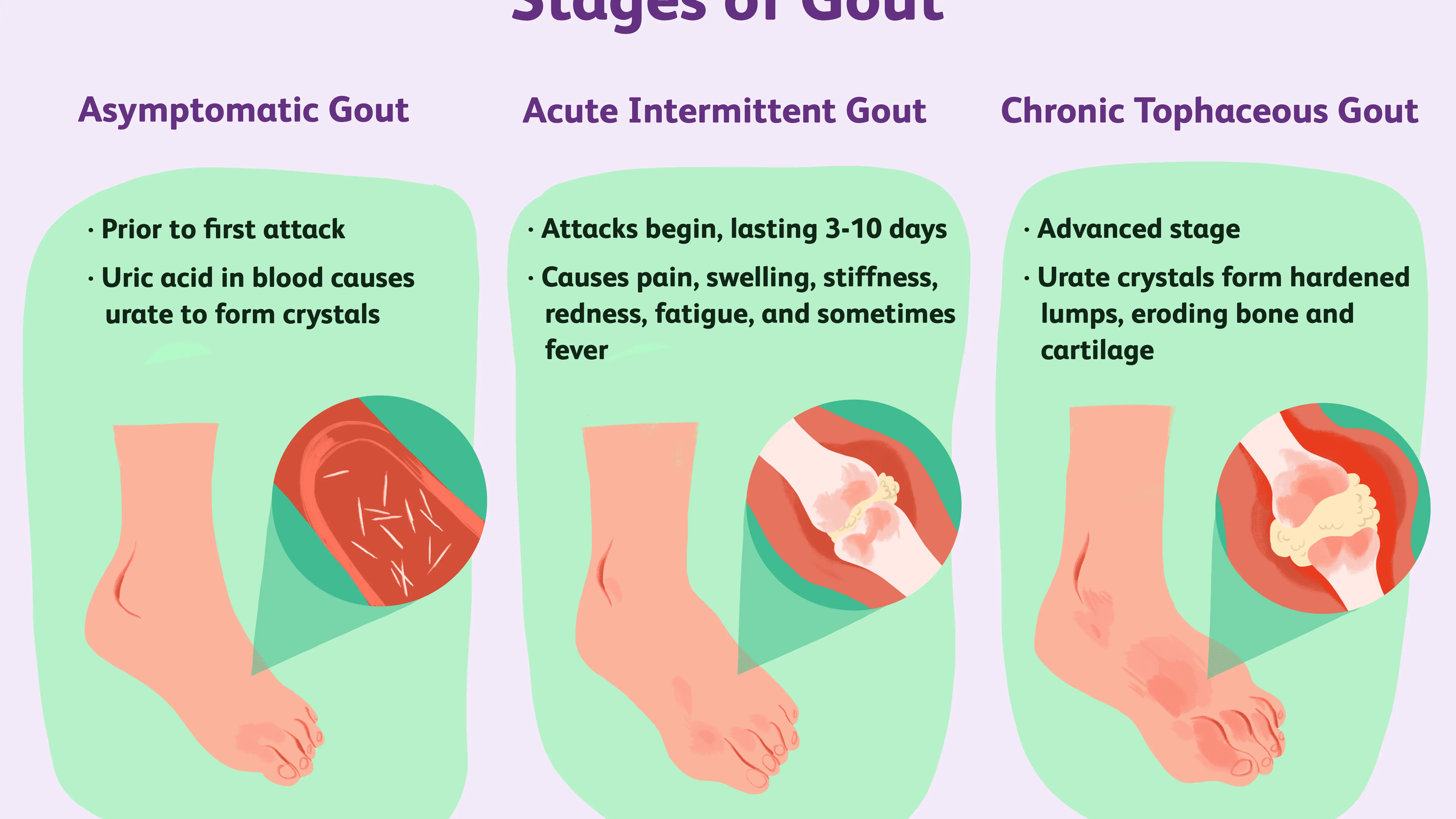 Uric acid in the blood