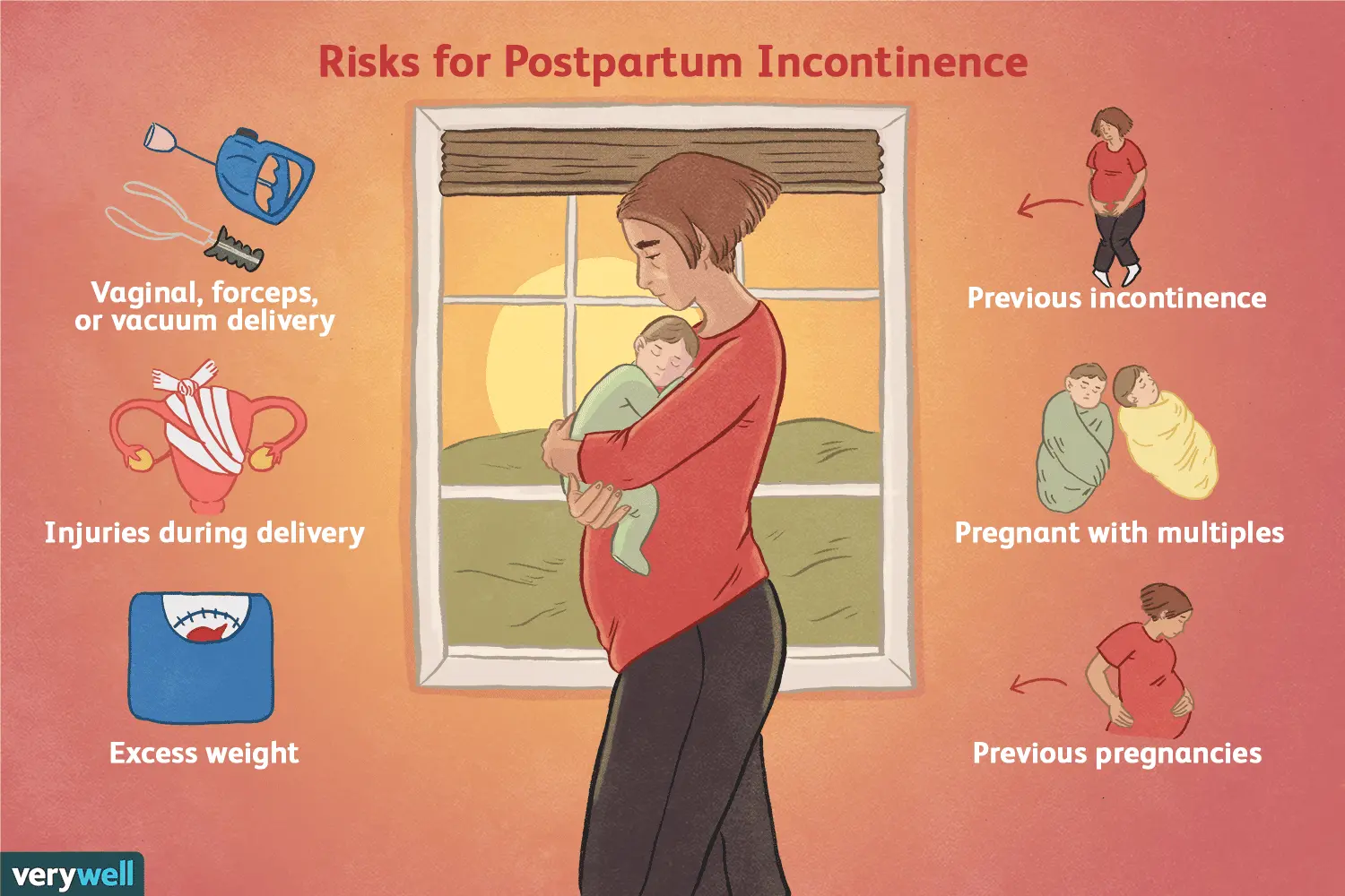 Urinary incontinence in women after childbirth