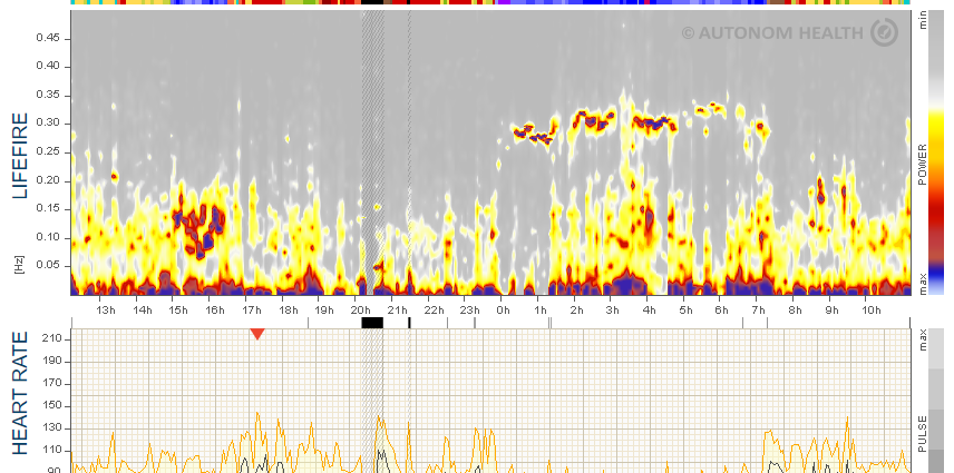 Weather sensitivity in adults