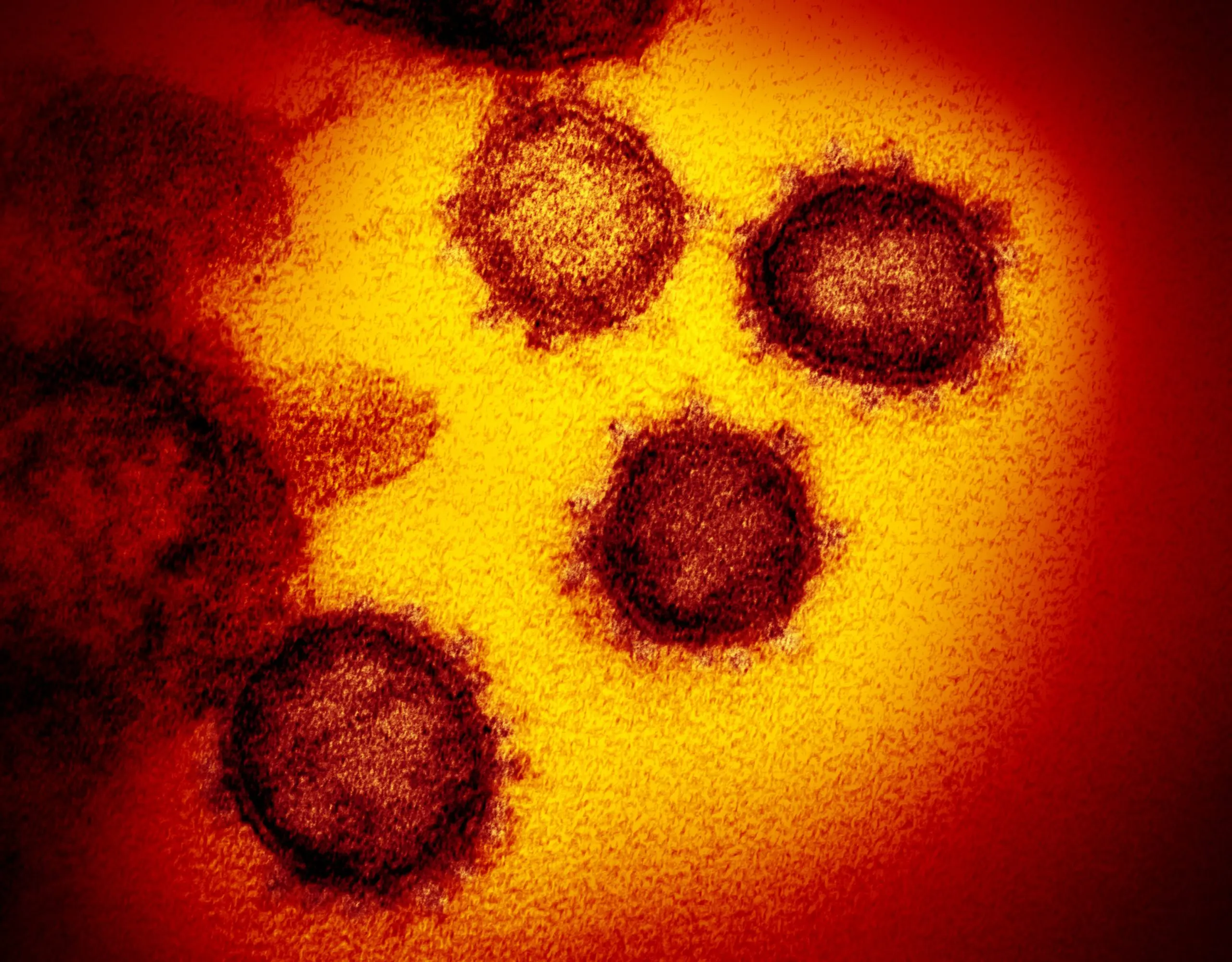 What the coronavirus looks like: the first photos