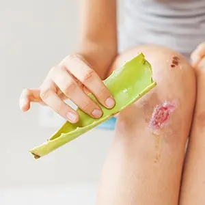 Wound healing: how to speed up the process at home