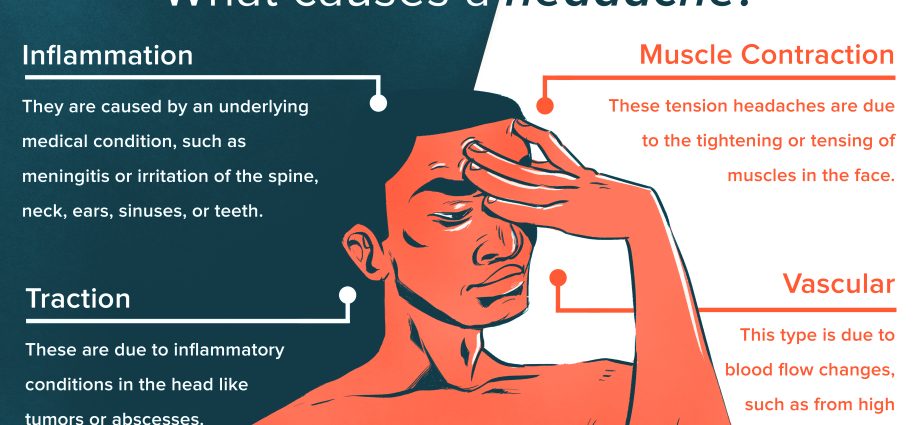 10 ways to deal with a headache without medication