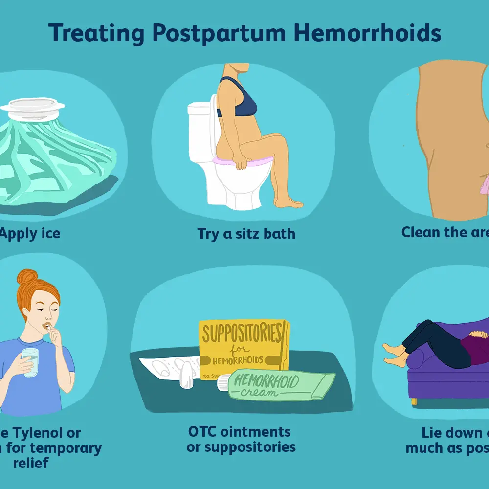 9 ways to treat hemorrhoids