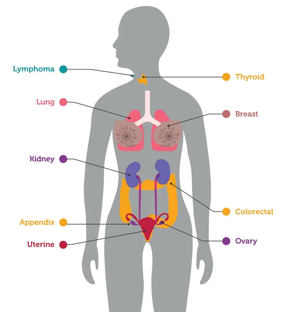 A blood test to predict whether the cancer will spread