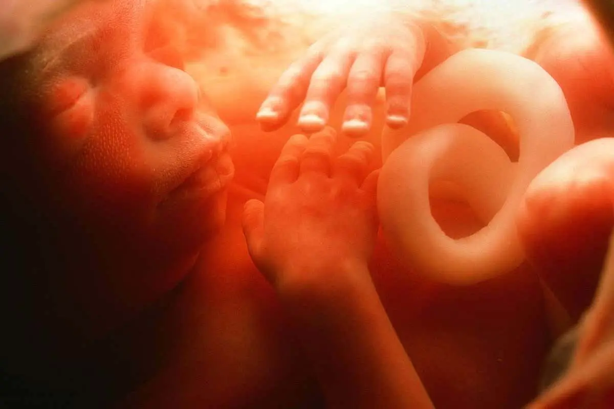 A blood test will reveal genetic defects in the fetus
