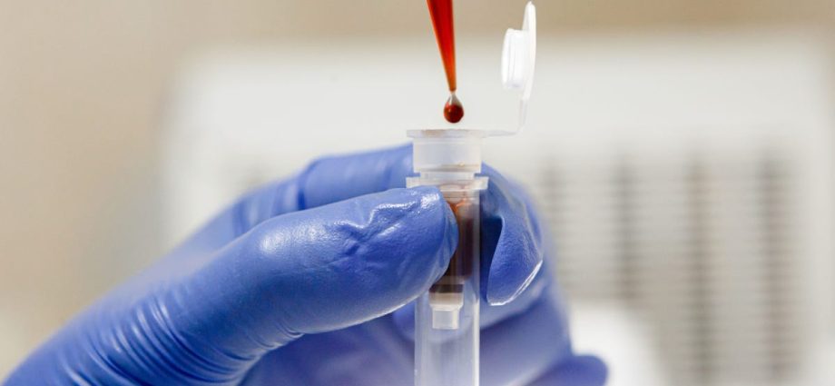 A blood test will show if cancer treatment is working. Result in 24 hours