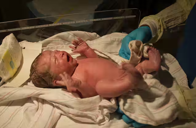 A boy with three penises was born in Iraq. This is the first case of trifalia in the world