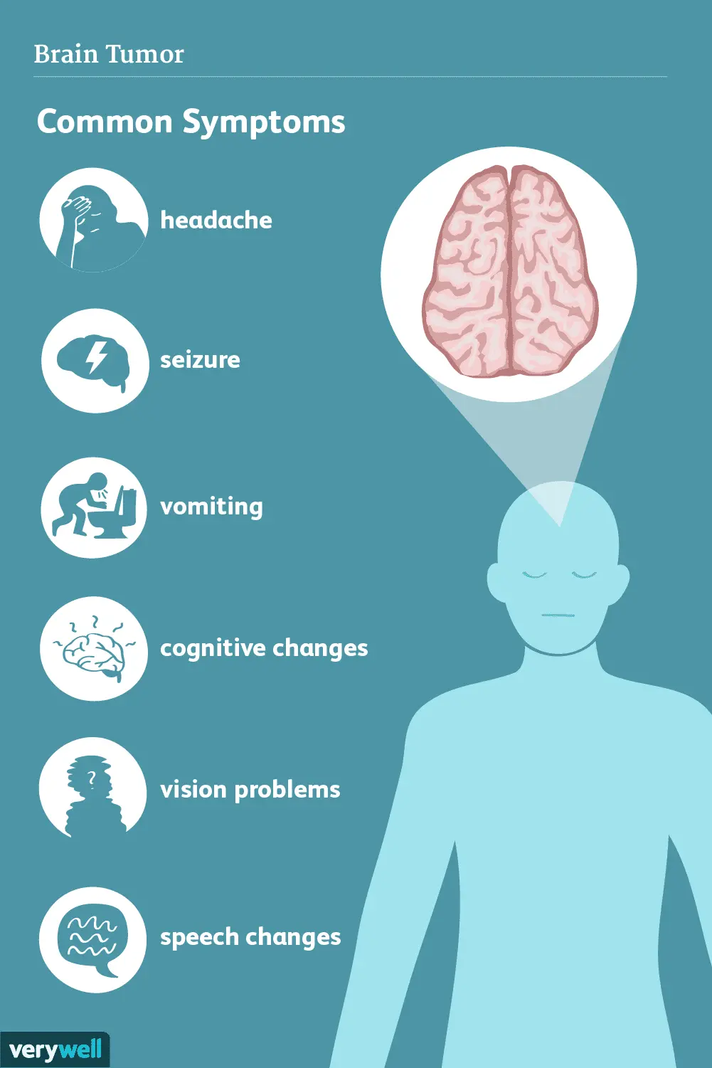 A brain tumor. What are the symptoms and what causes it?